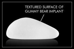 gummy bear implant
