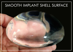 smooth iimplant shell surface